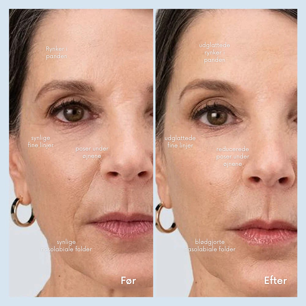 FacialWand™ | Skab en fastere. glattere og mere strålende hud